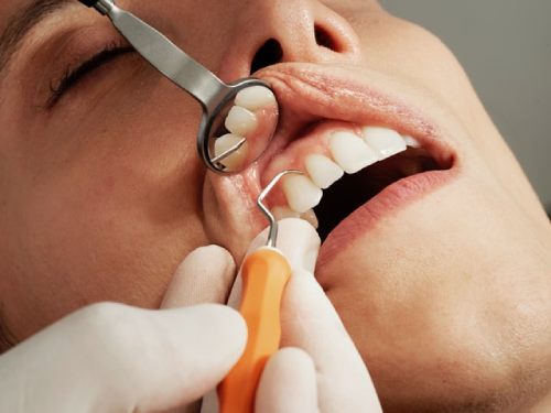 movilidad dental en periodoncia