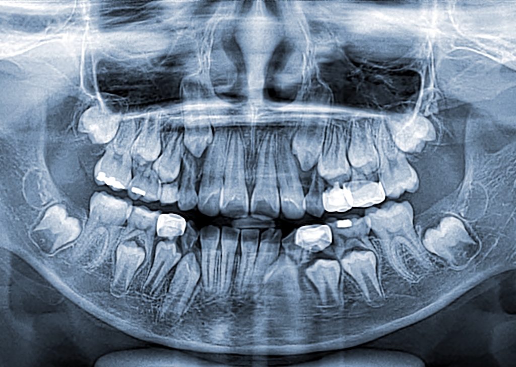 todos los tipos de radiografías dentales