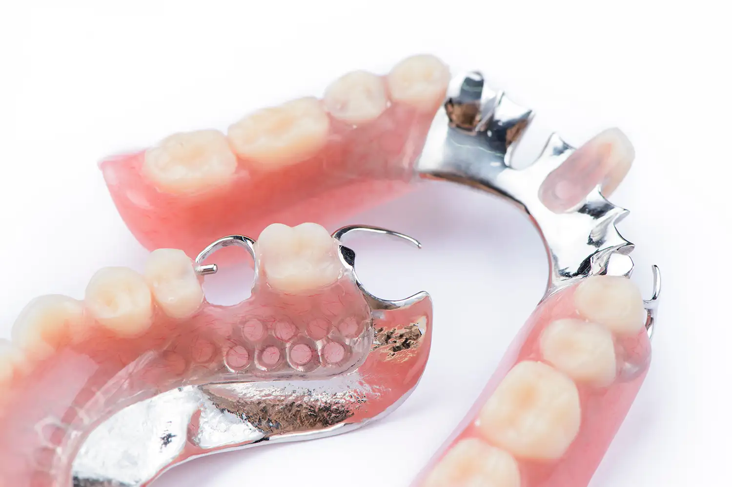 Prótesis dental parcial